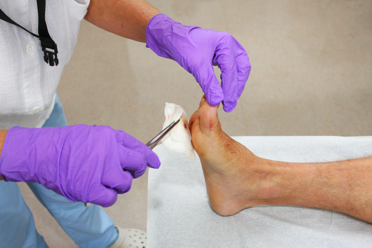 Over 50 percent cure rate for chronic wound care patients | Voice of